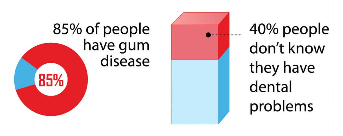 Periodontal Disease Stages